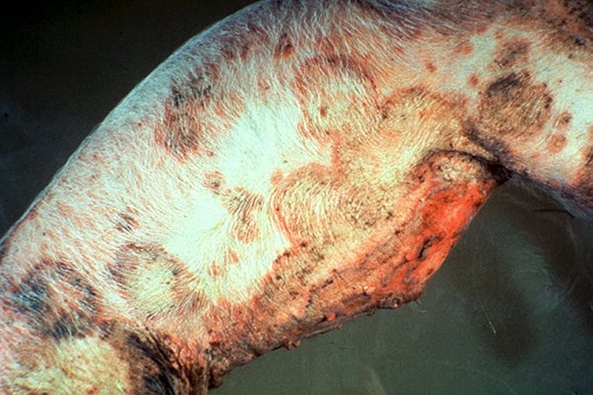 Pityriasis rosea, ring-like lesions, pig
