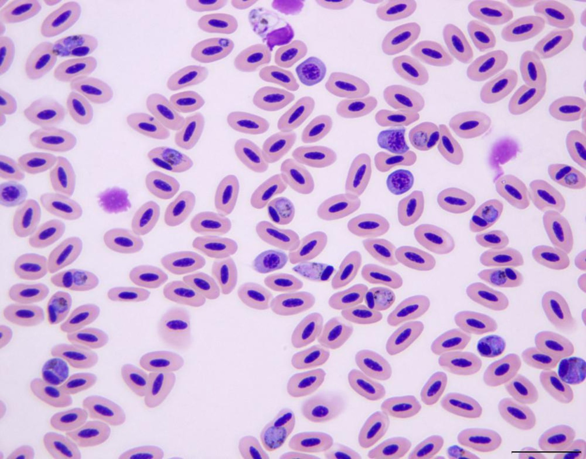 <i >Plasmodium</i> spp, blood smear
