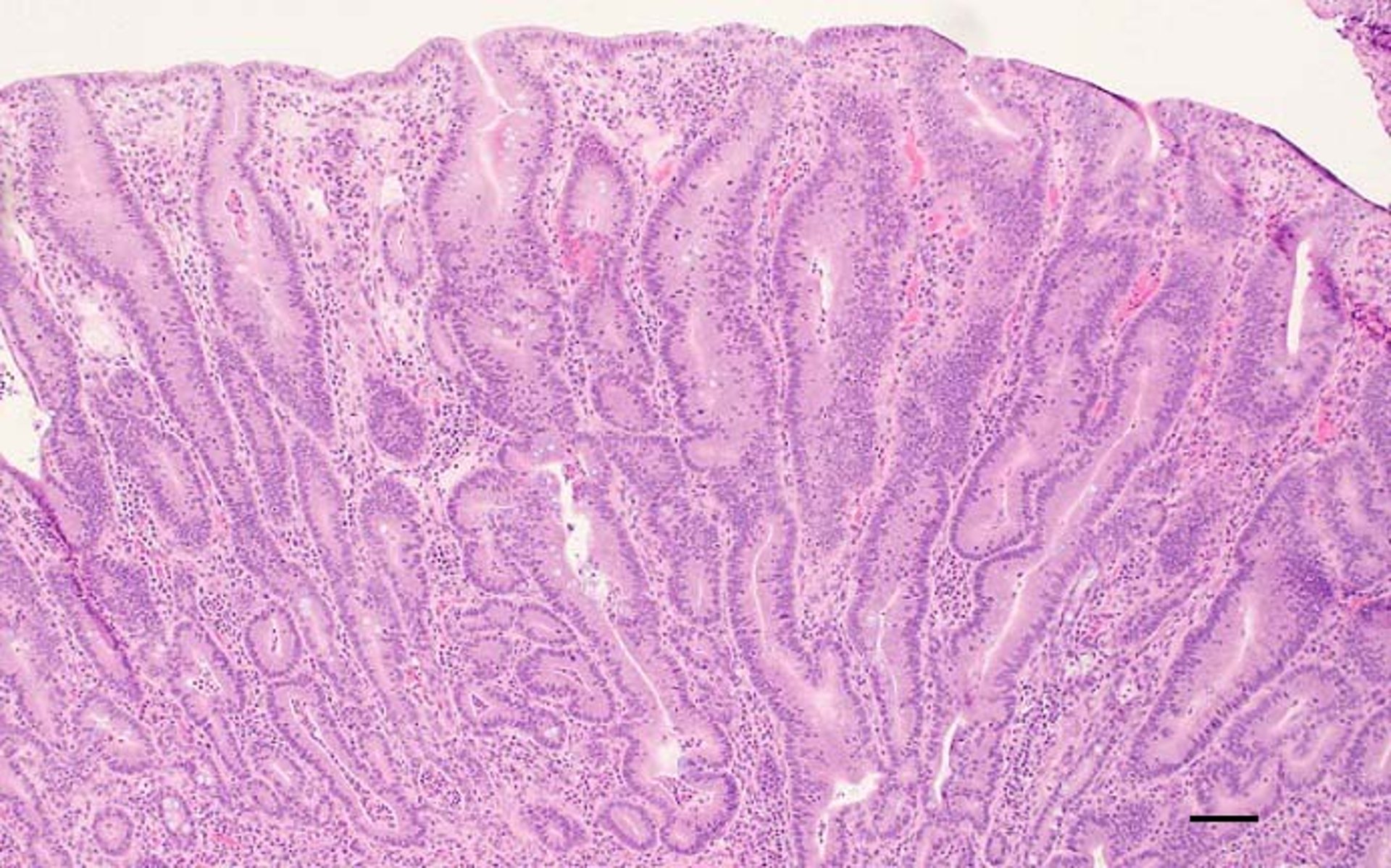 Porcine proliferative enteropathy, histopathology, pig