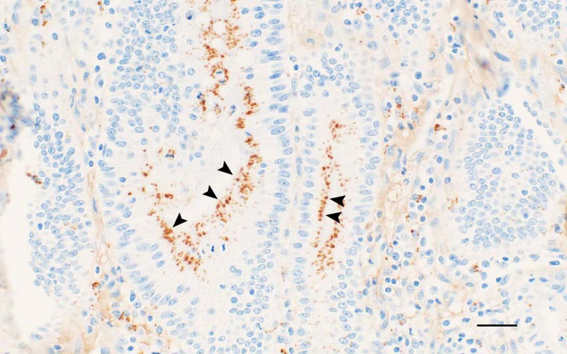 Porcine proliferative enteropathy, immunohistochemistry, pig