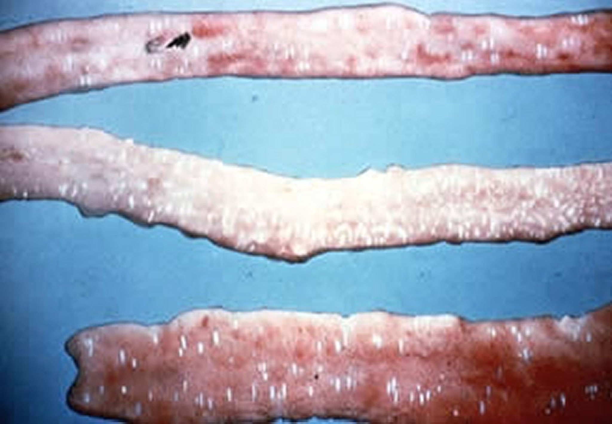 <i >Eimeria acervulina</i>, gross lesions, chicken