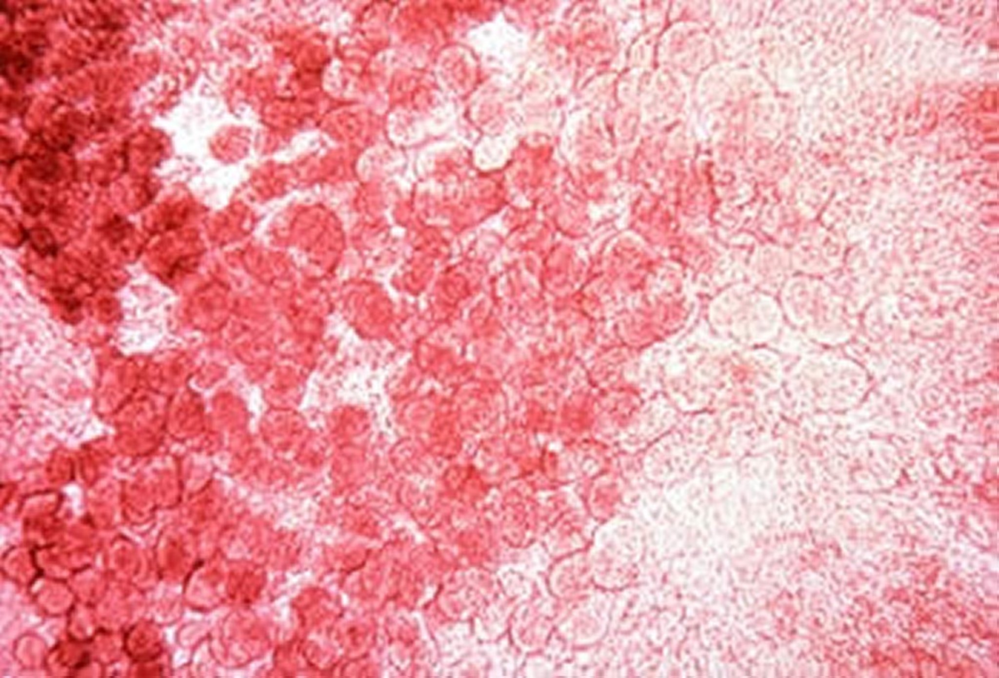 <i >Eimeria necatrix</i>, developmental stages, poultry