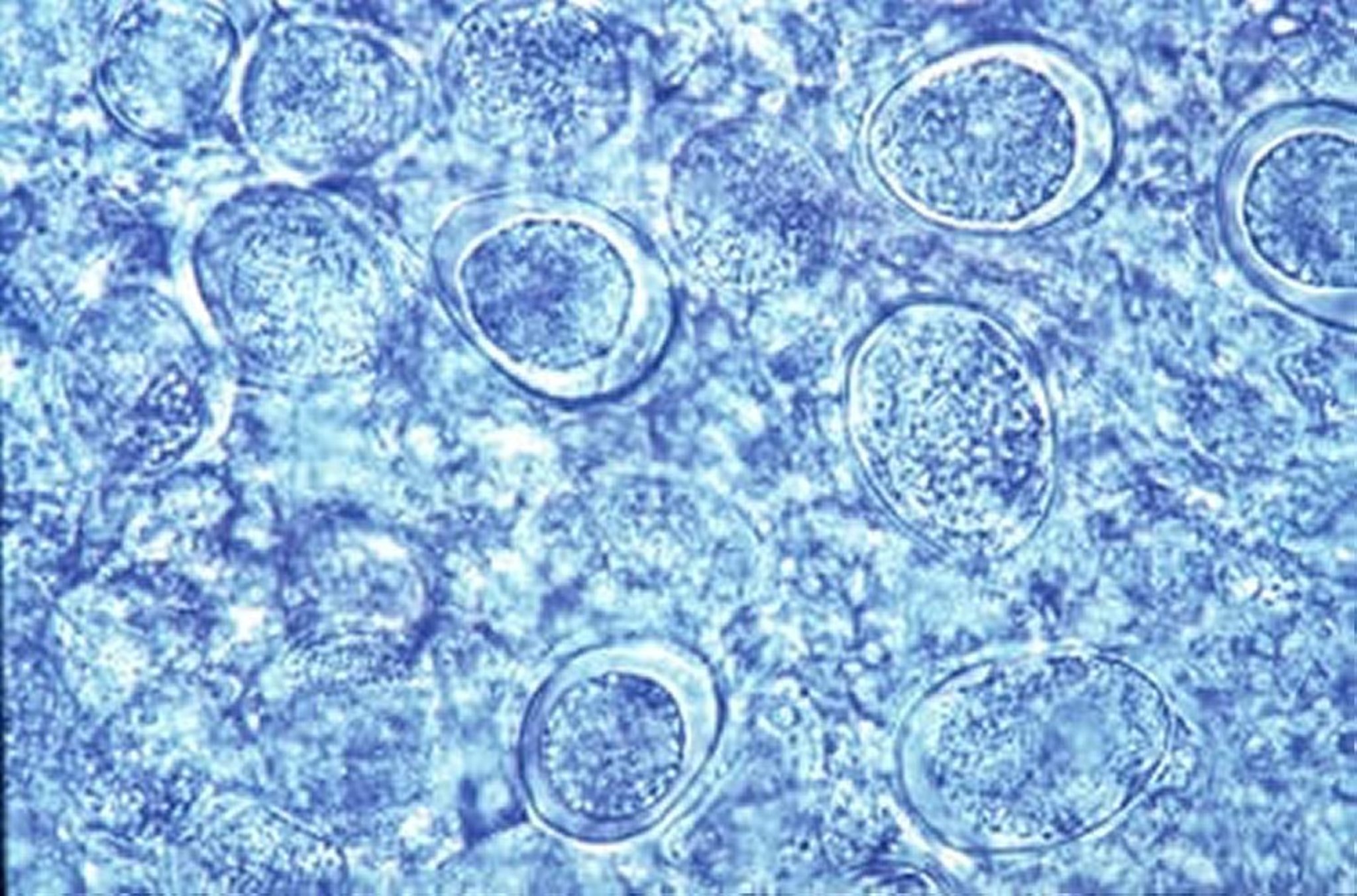 <i >Eimeria brunetti</i>, oocysts, poultry