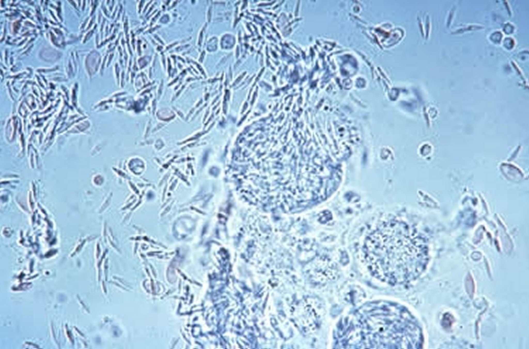 Release of merozoite from mature schizont
