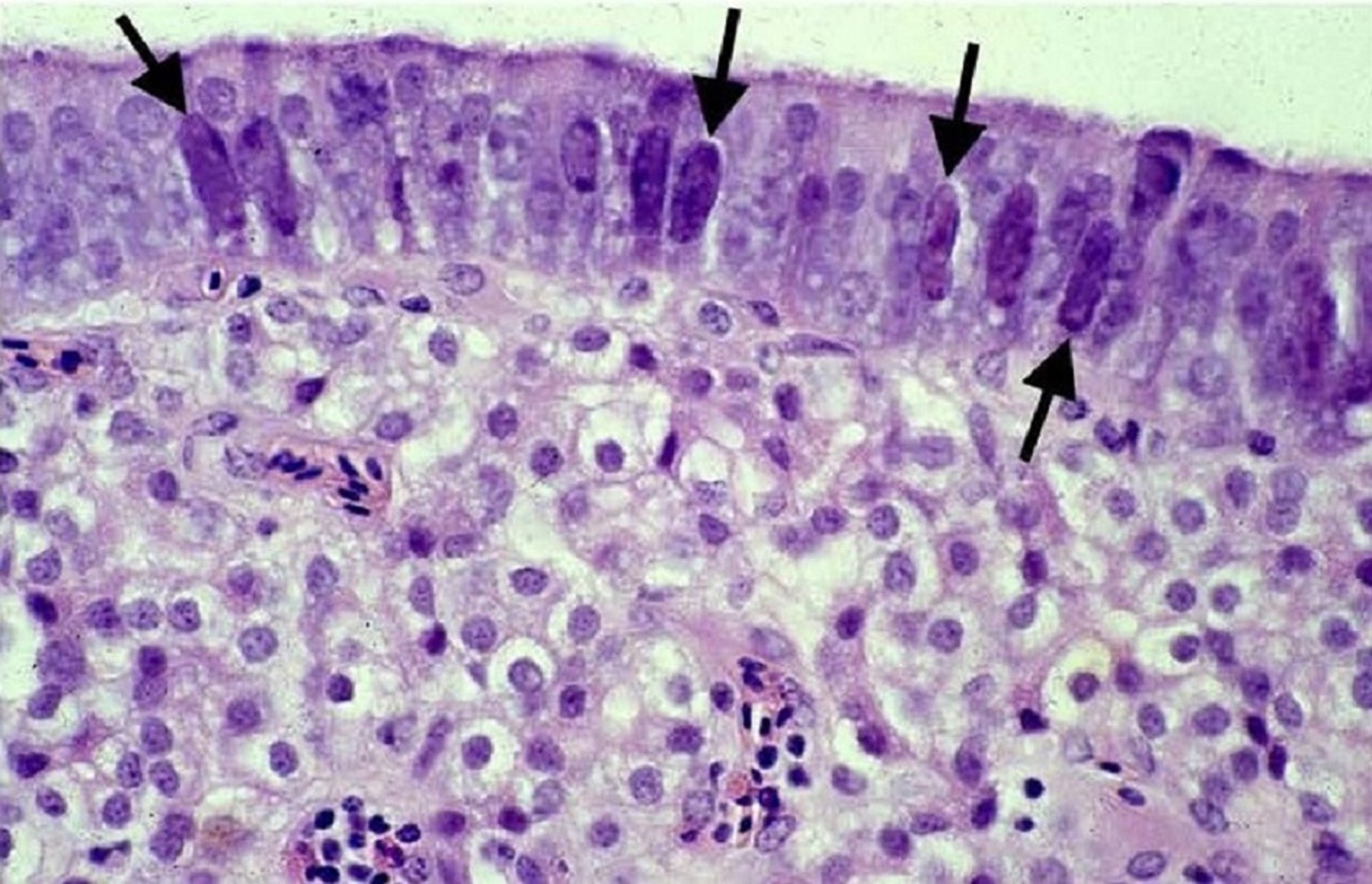 Pouch shell gland mucosa, laying hen