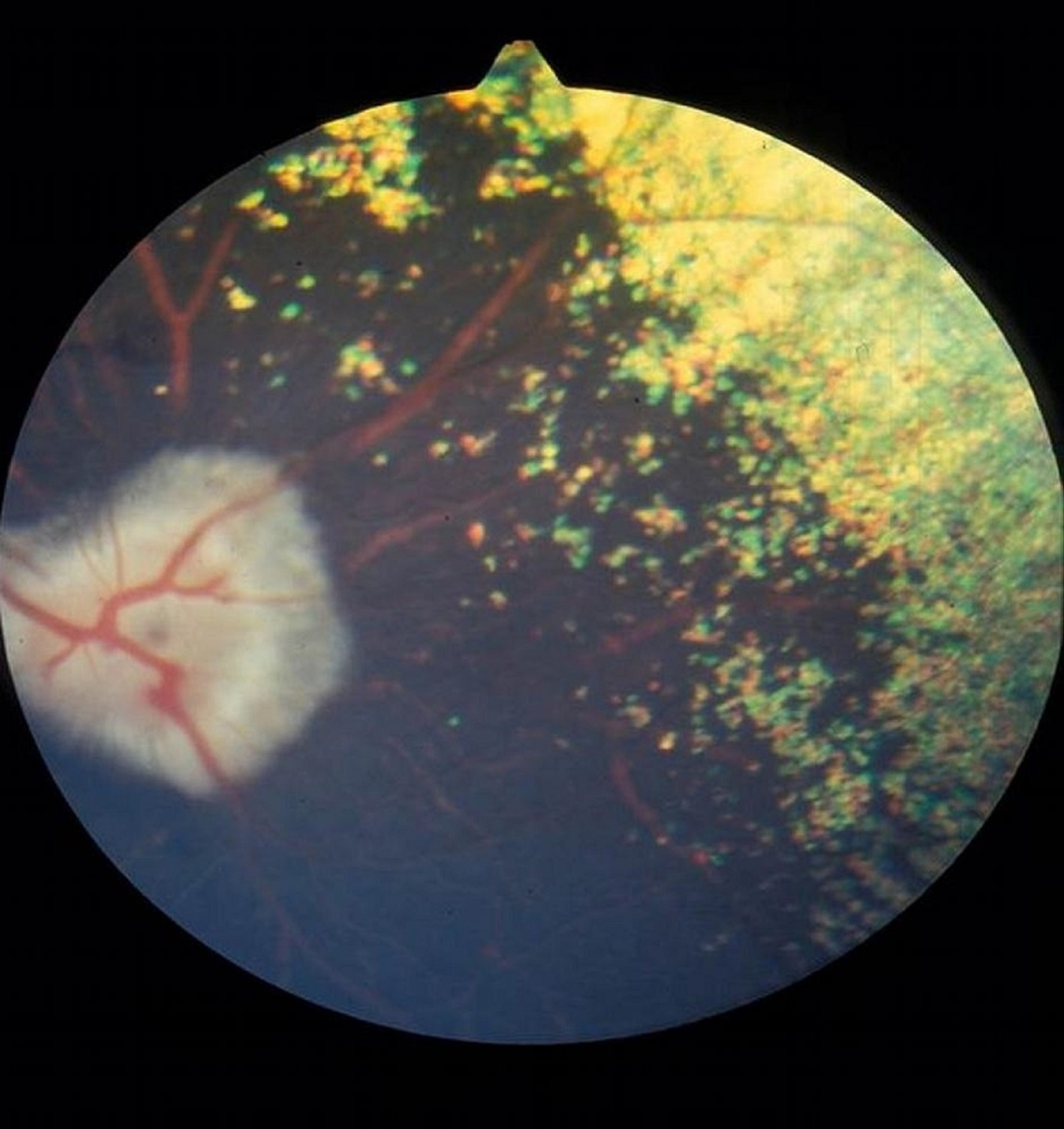 Progressive retinal atrophy, dog