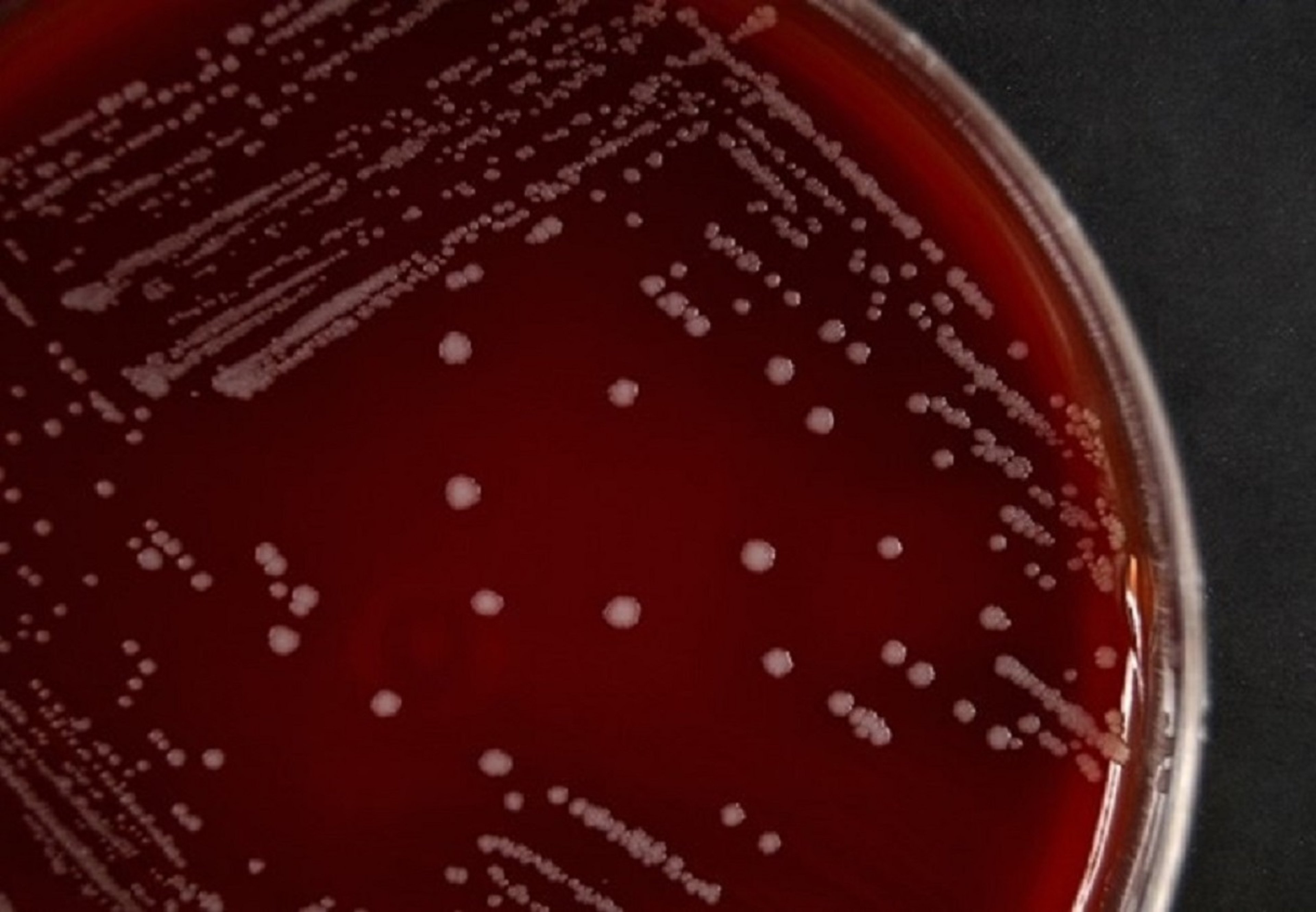<i >Prototheca bovis on blood agar</i>