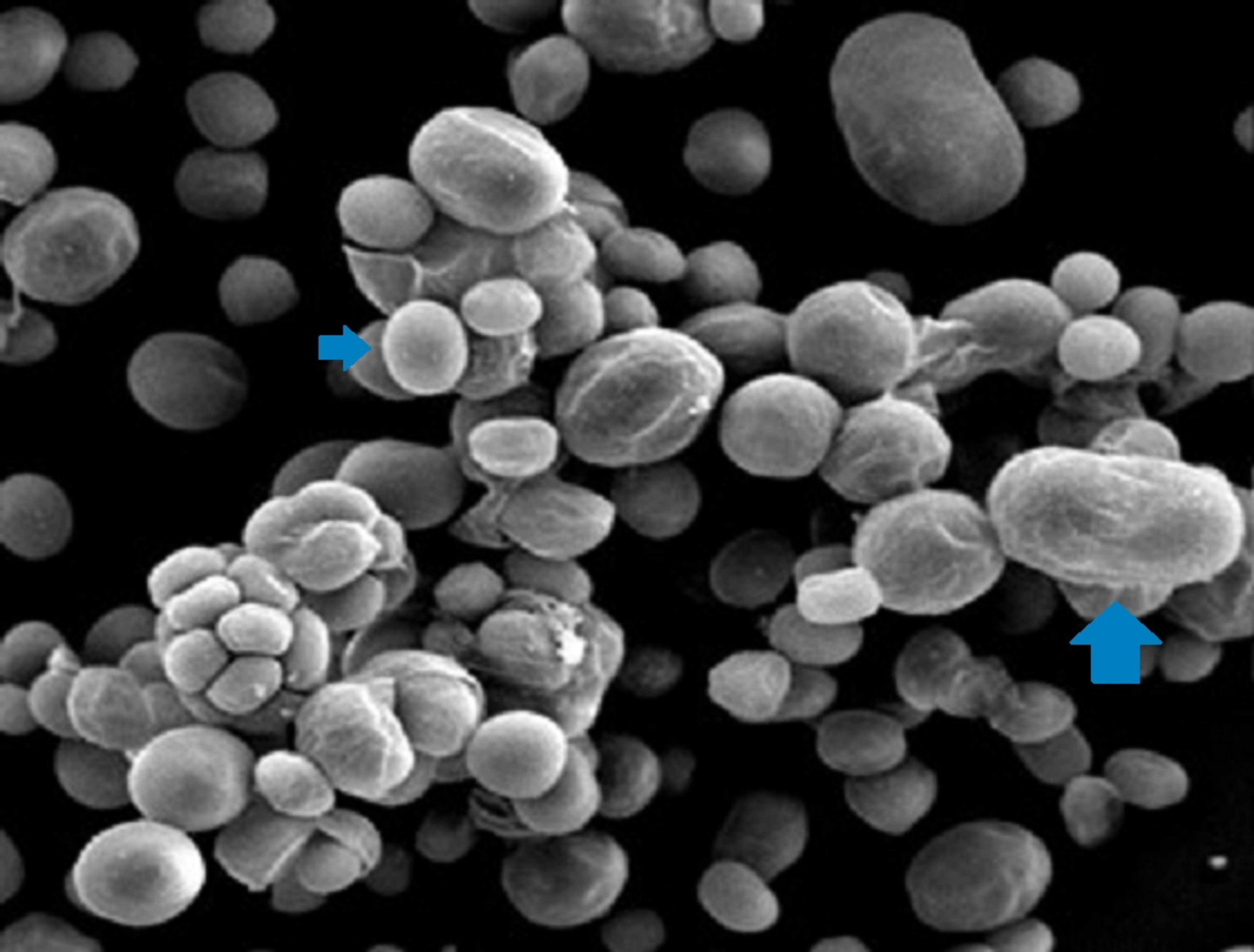 Prototheca bovis sporangia and sporangiospores