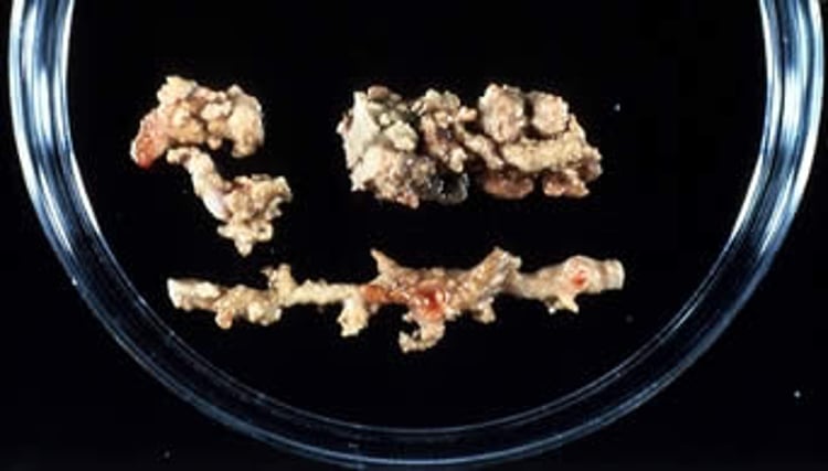 <i >Pythium insidiosum</i>, "kunkers"