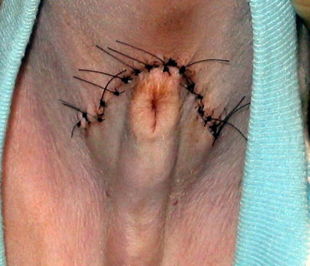 Partial phimosis, dog (postoperative)