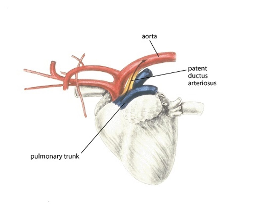 Patent ductus arteriosus, dog