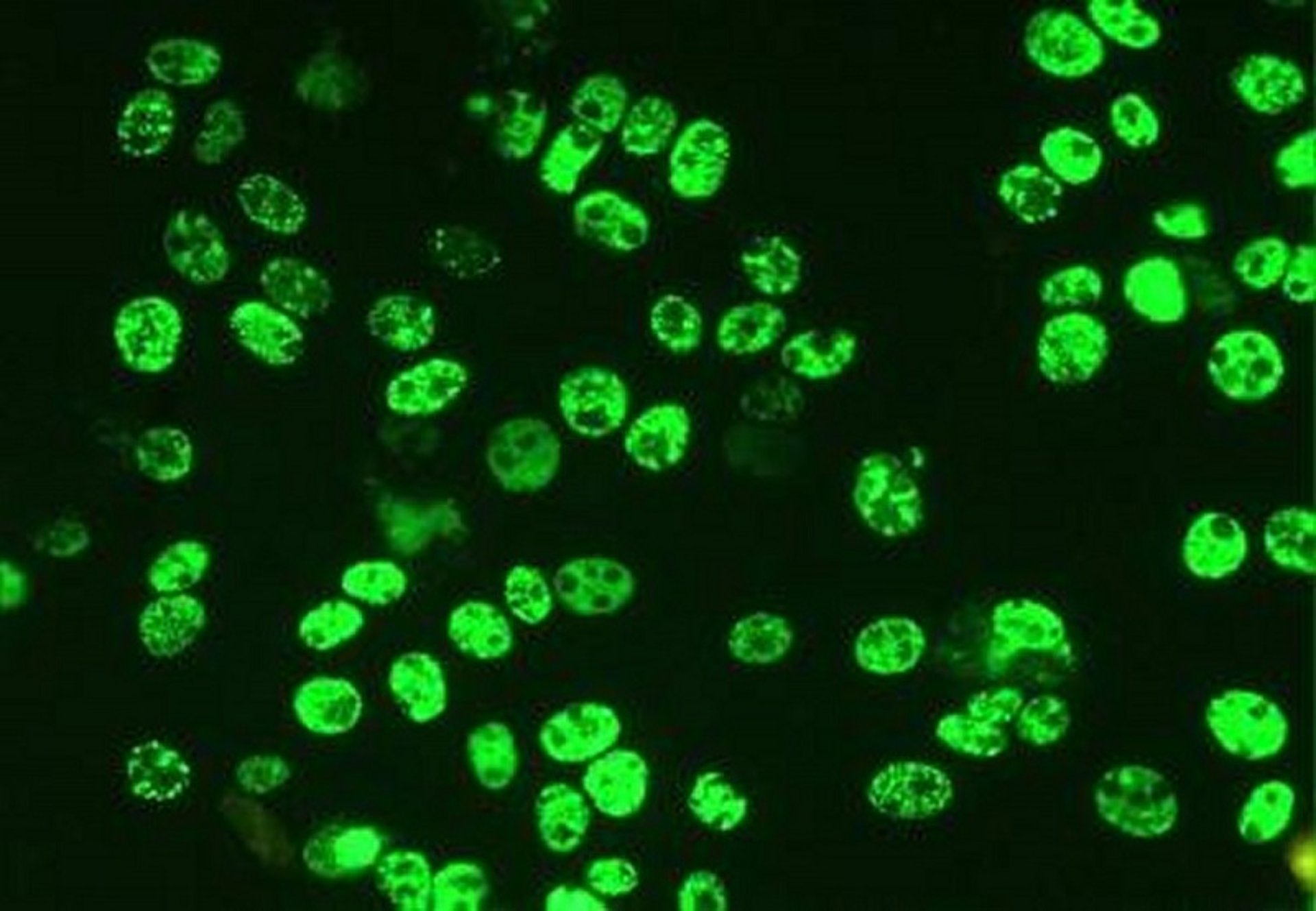 Porcine circovirus 2, immunofluorescence, photomicrograph