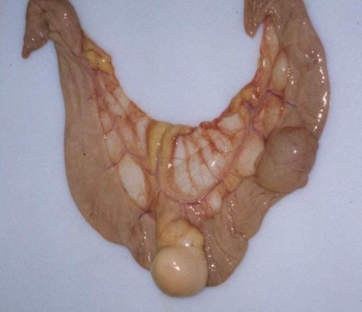 Lipoma pedunculado, caballo