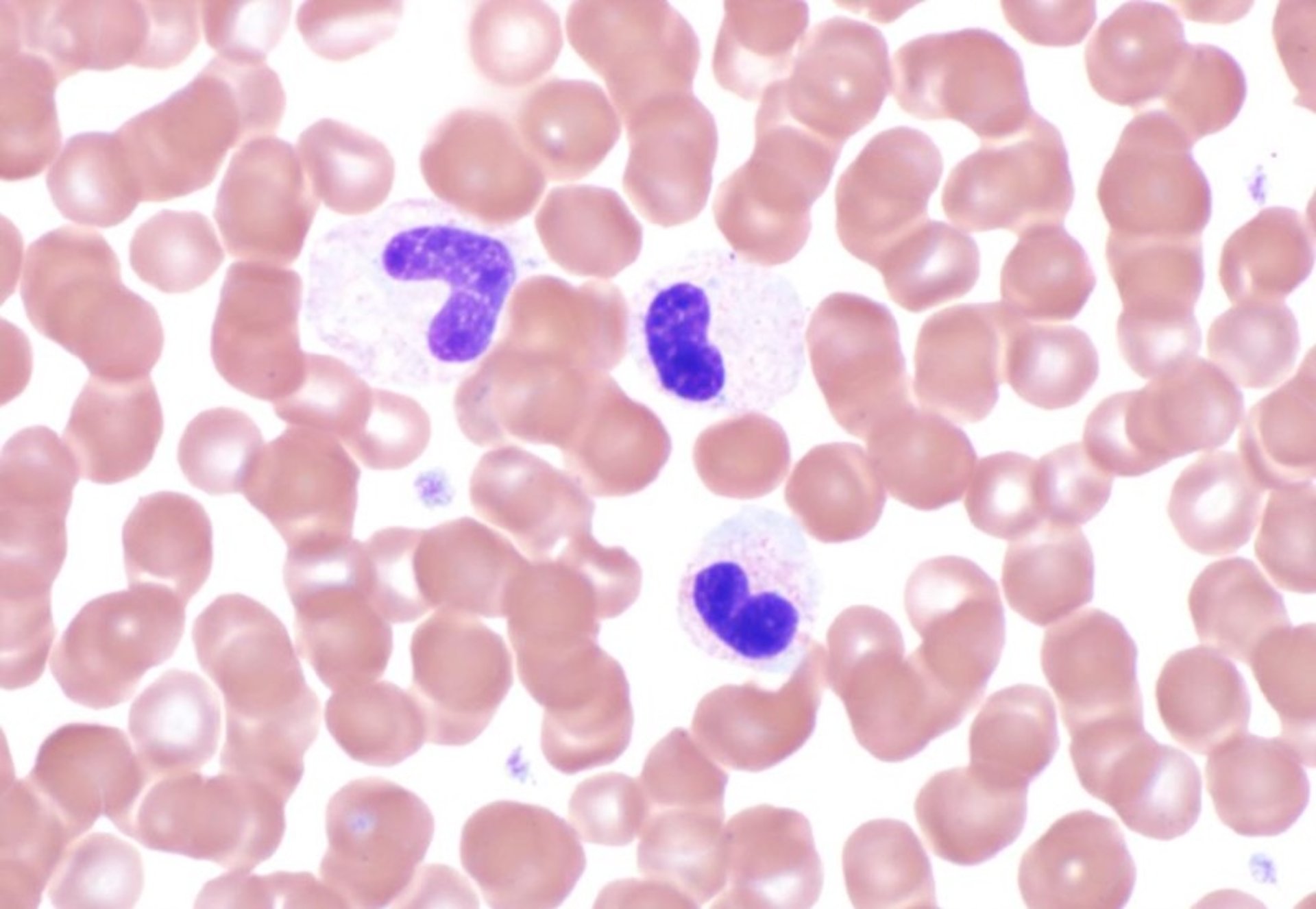 Pelger-Huët anomaly, blood smear, dog