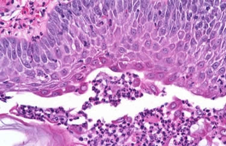 Pemphigus foliaceus, histopathologic lesions, dog