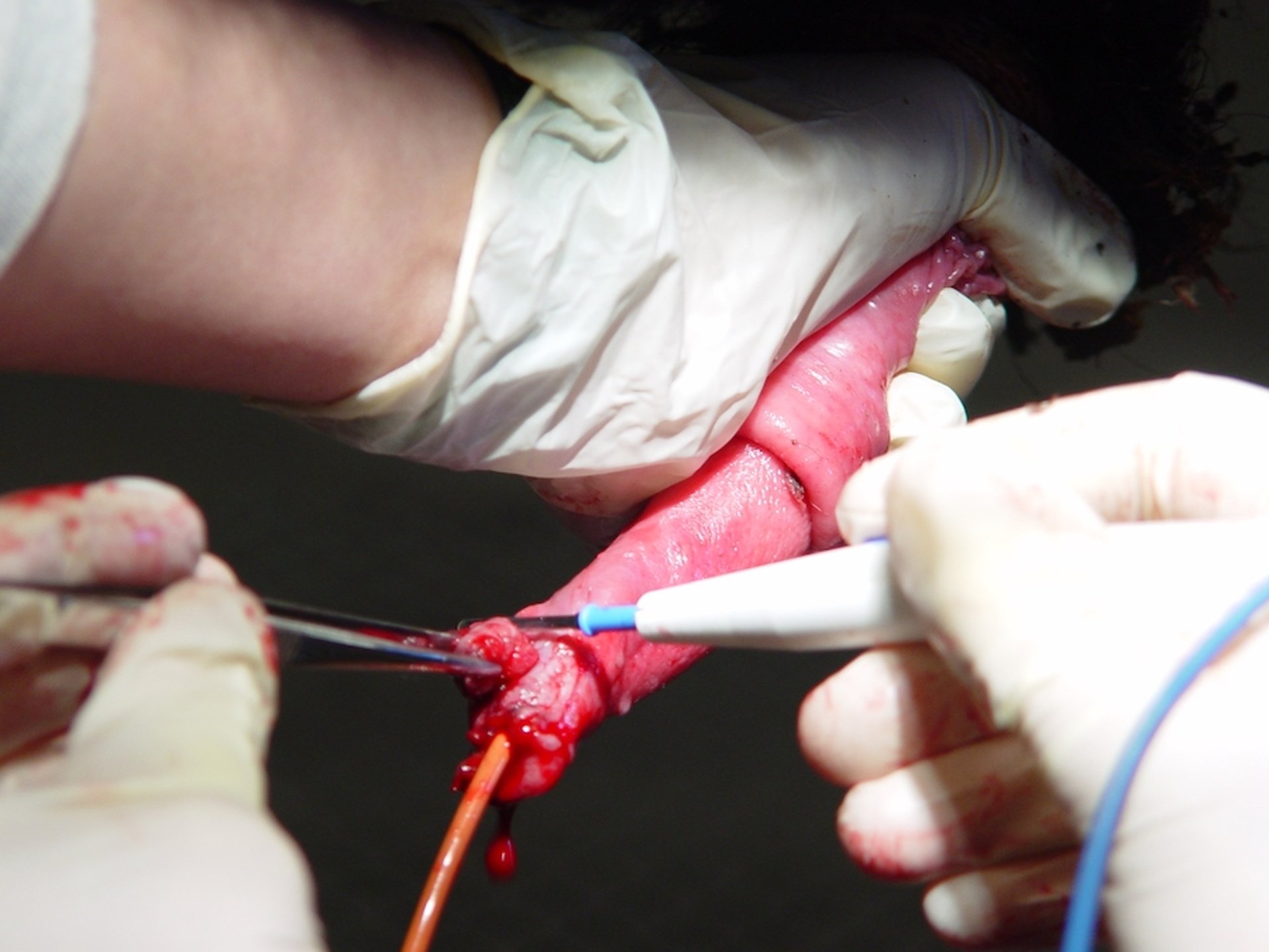 Penile papilloma resection, bull