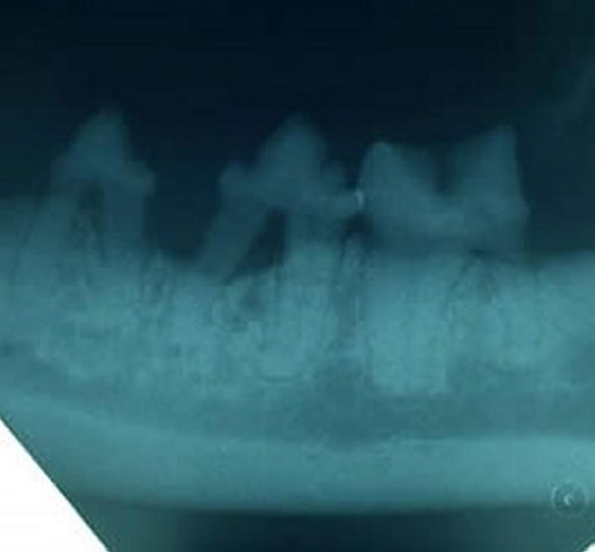 Periodontitis, radiografía, gato