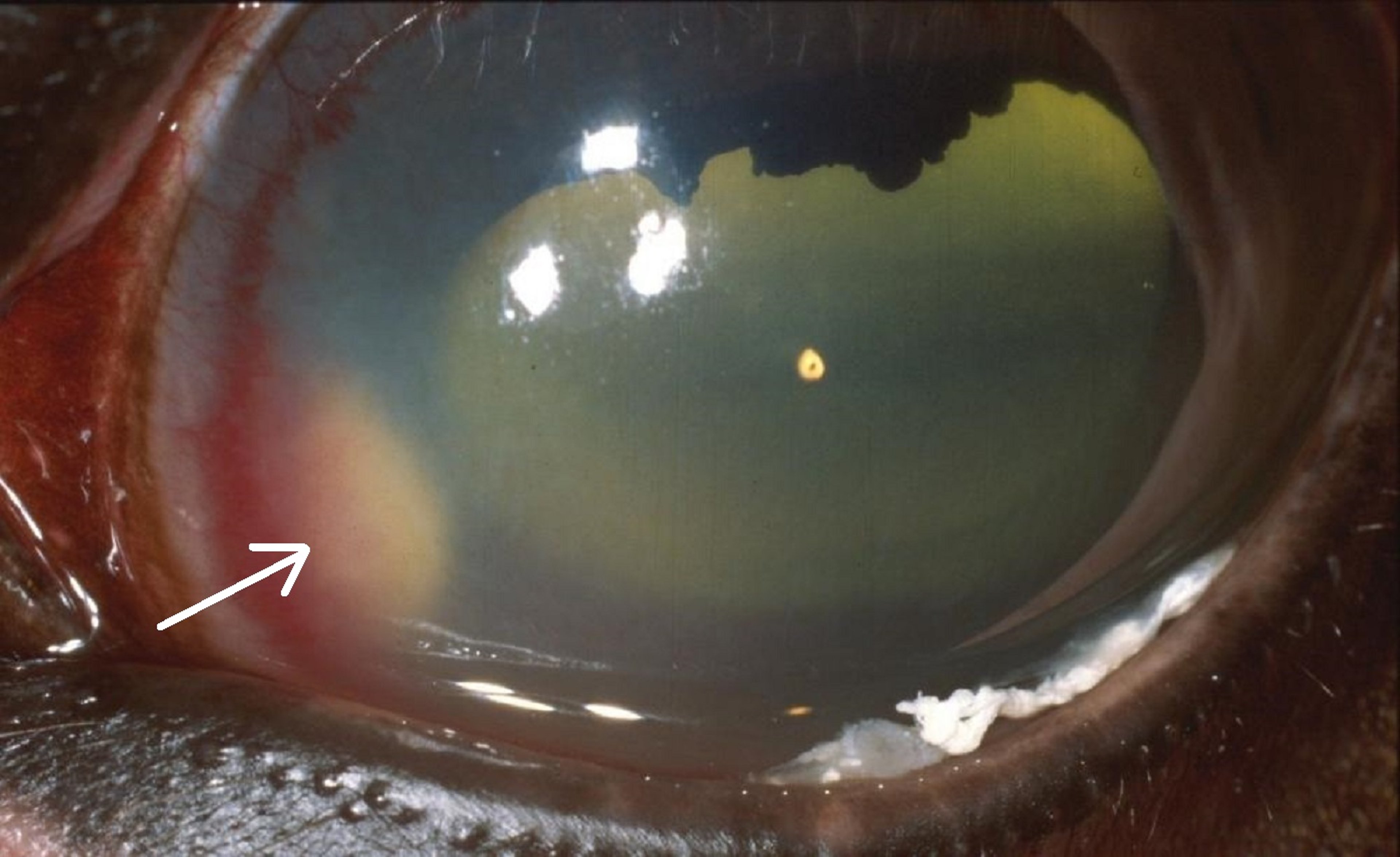 Absceso corneal estromal profundo periférico, caballo