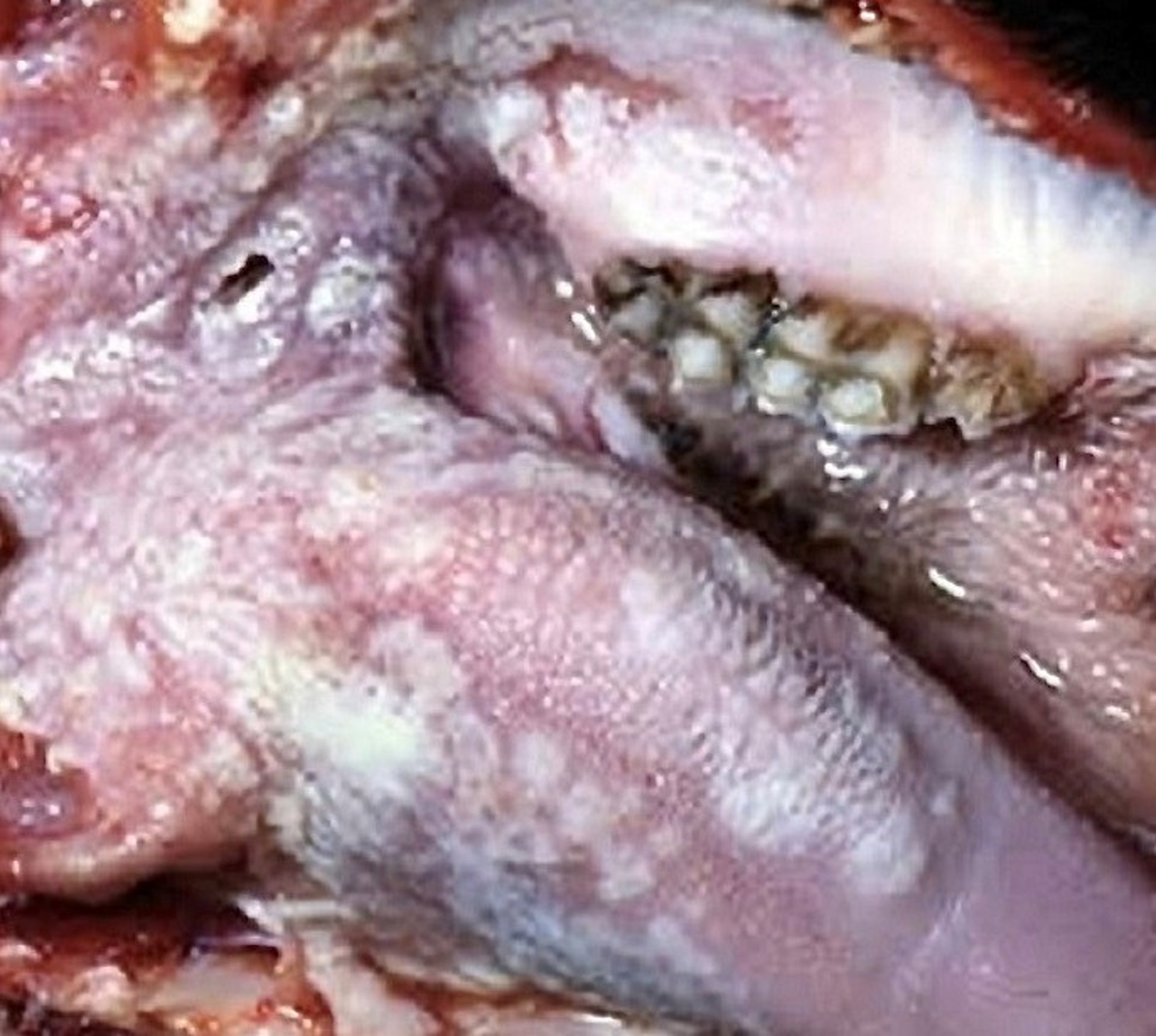 Peste de los pequeños rumiantes, lesiones orales, cabra