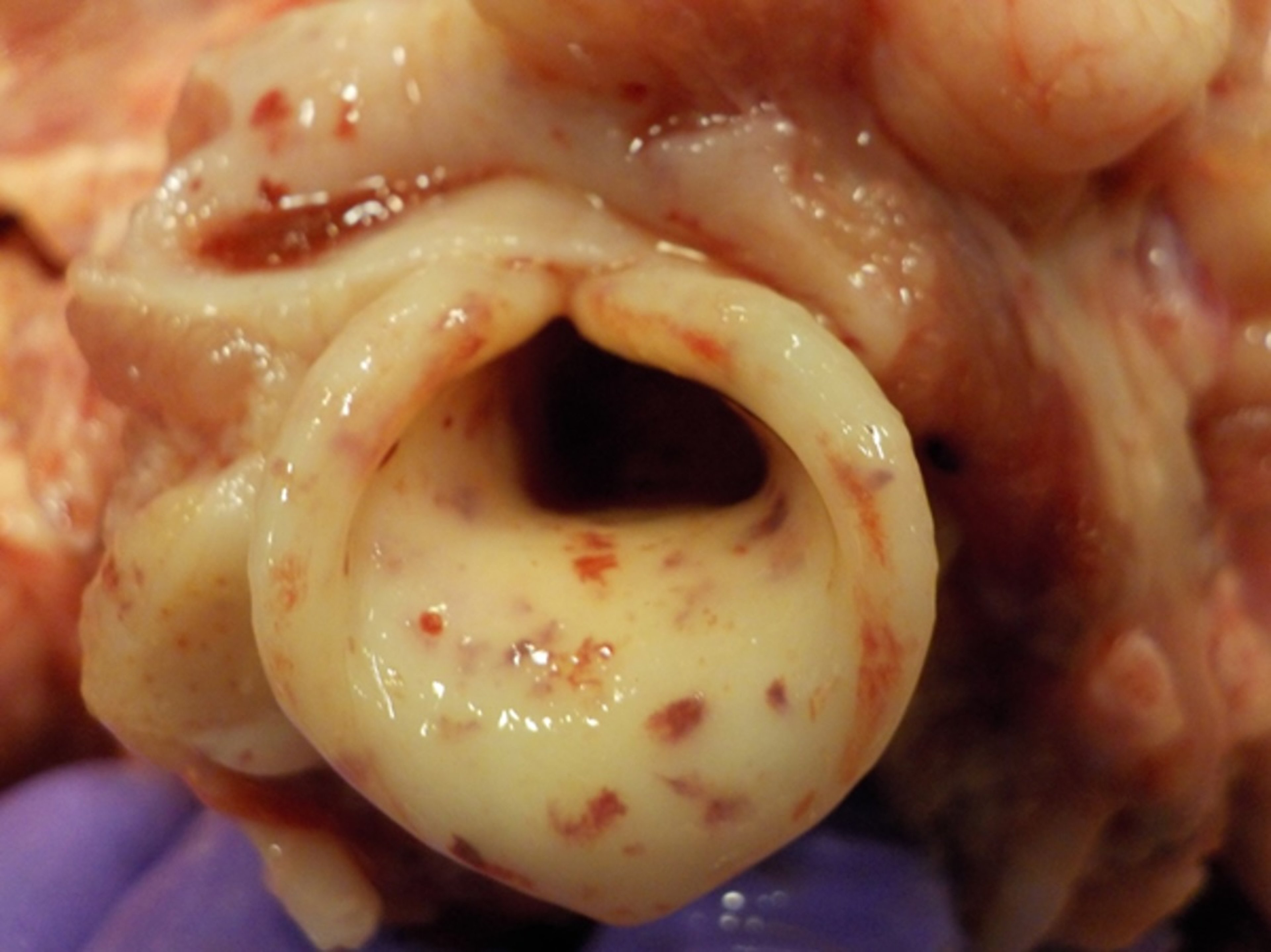 Petechial hemorrhages, epiglottis, pig