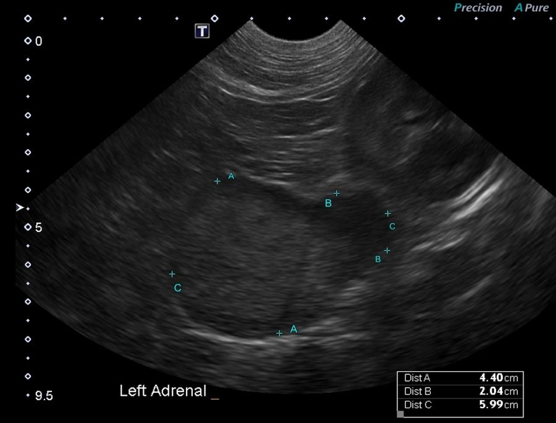 Pheochromocytoma, dog