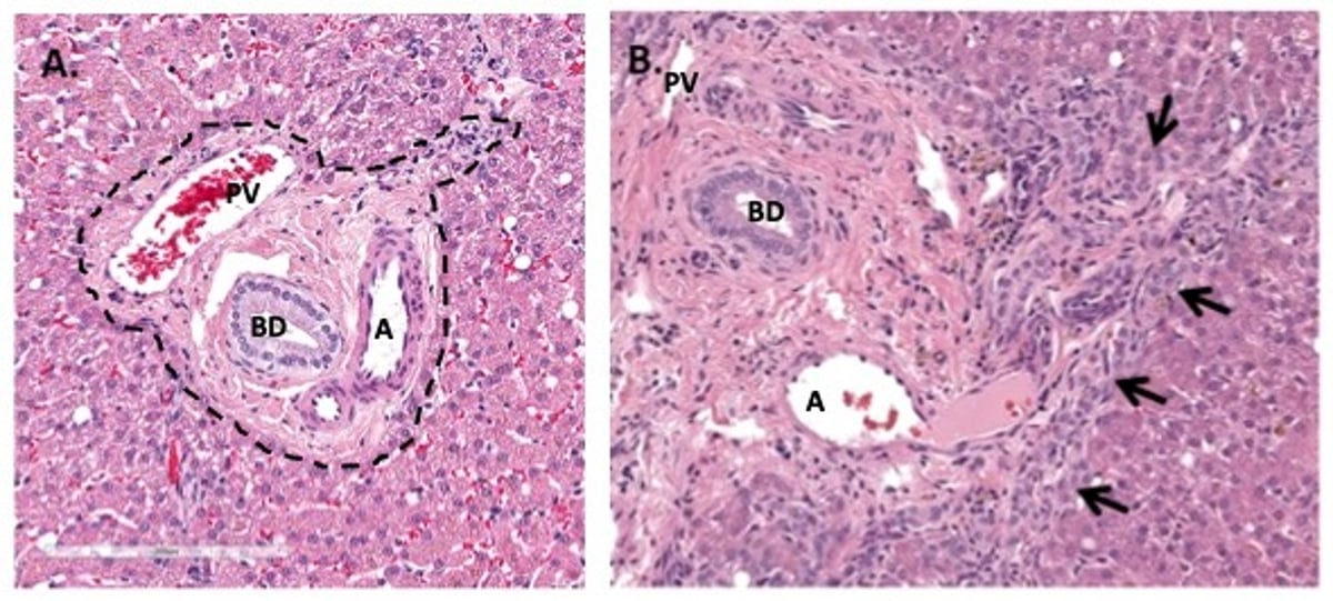 Portal tract, photomicrographs, with and without ductular reaction, dog