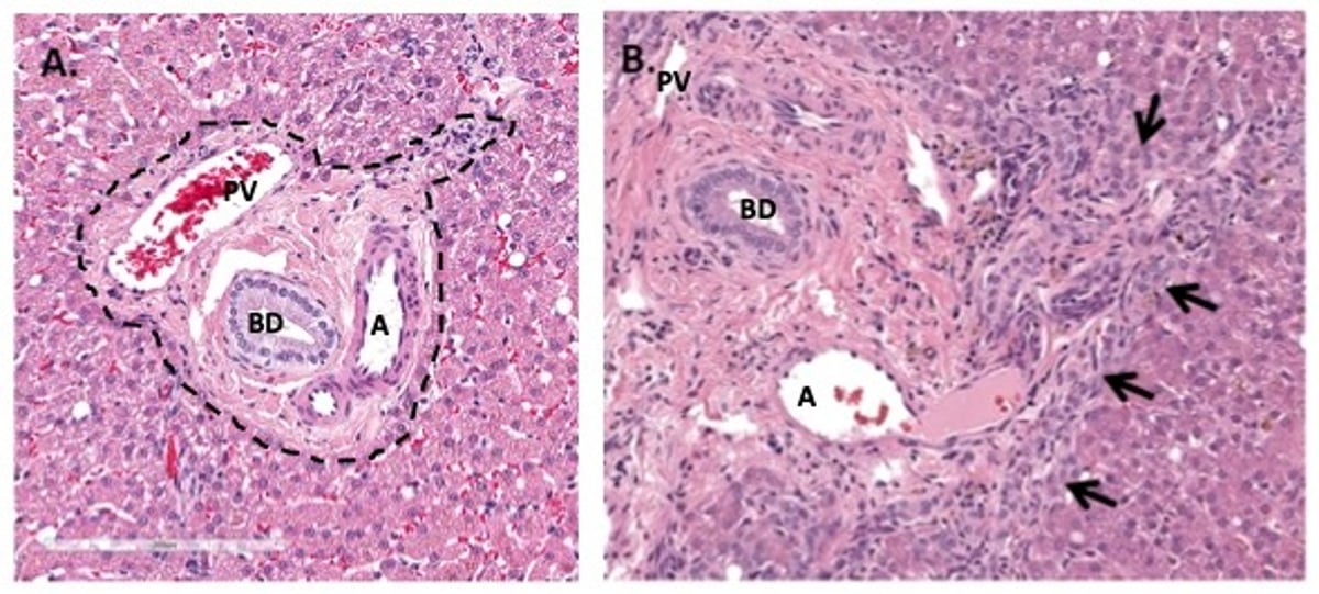 Portal tract, photomicrographs, with and without ductular reaction, dog