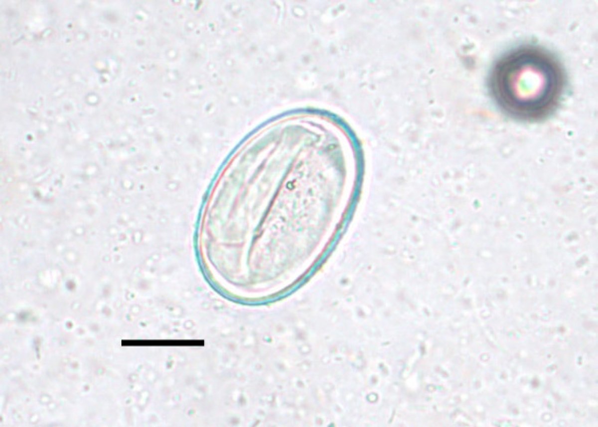 Huevo, <i >Physaloptera</i> spp, perro