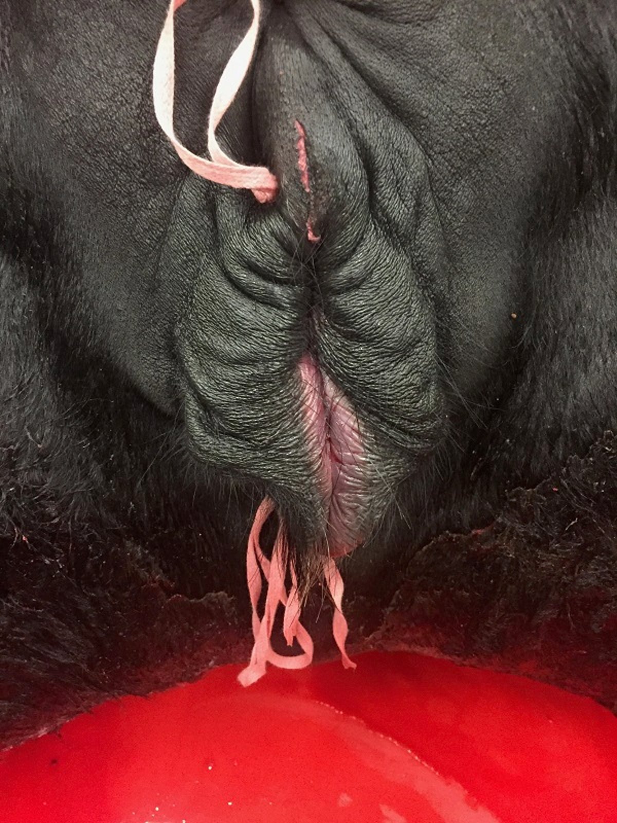Colocação de sutura de Buhner