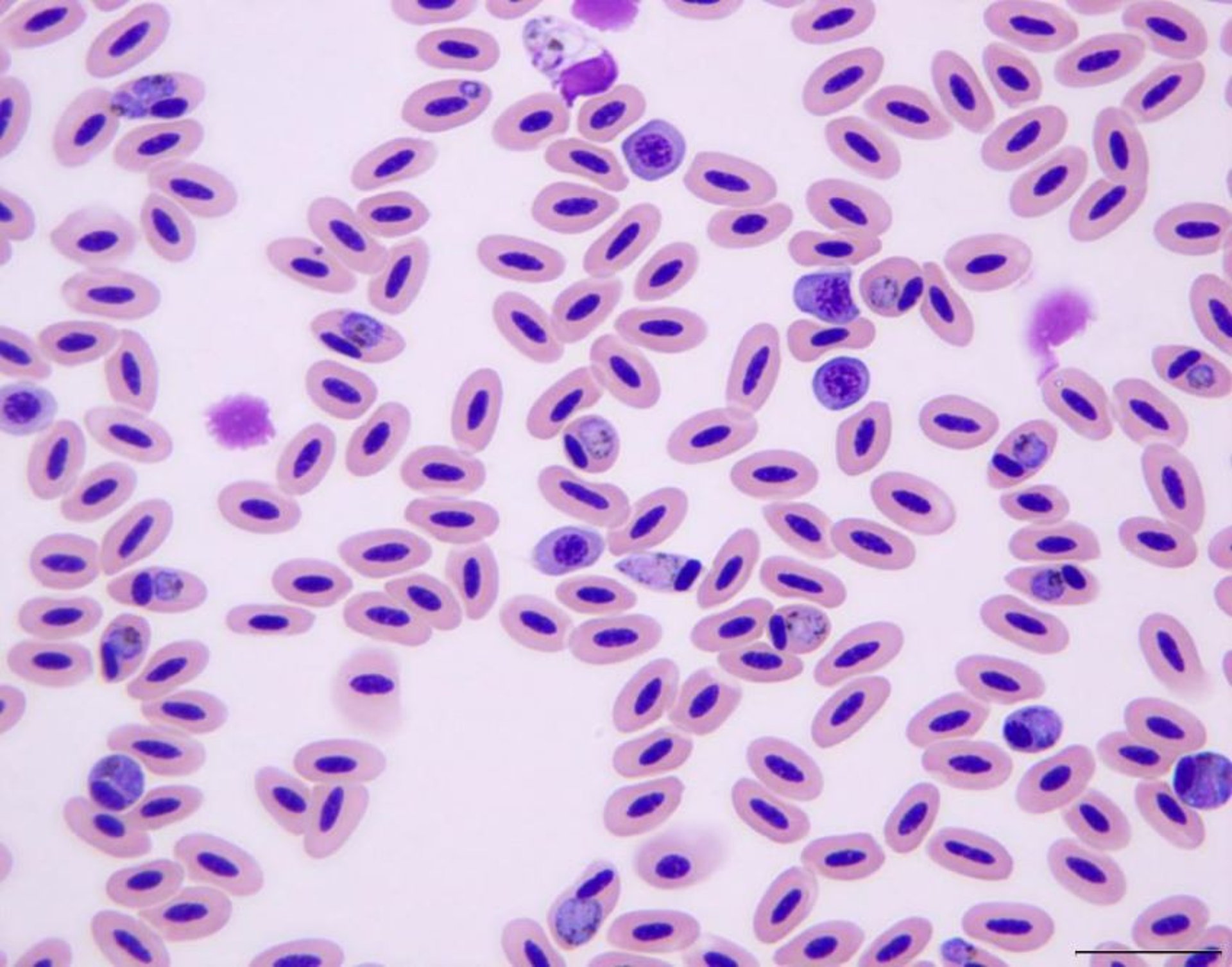 <i >Plasmodium</i> sp, photomicrograph, blood, gyrfalcon