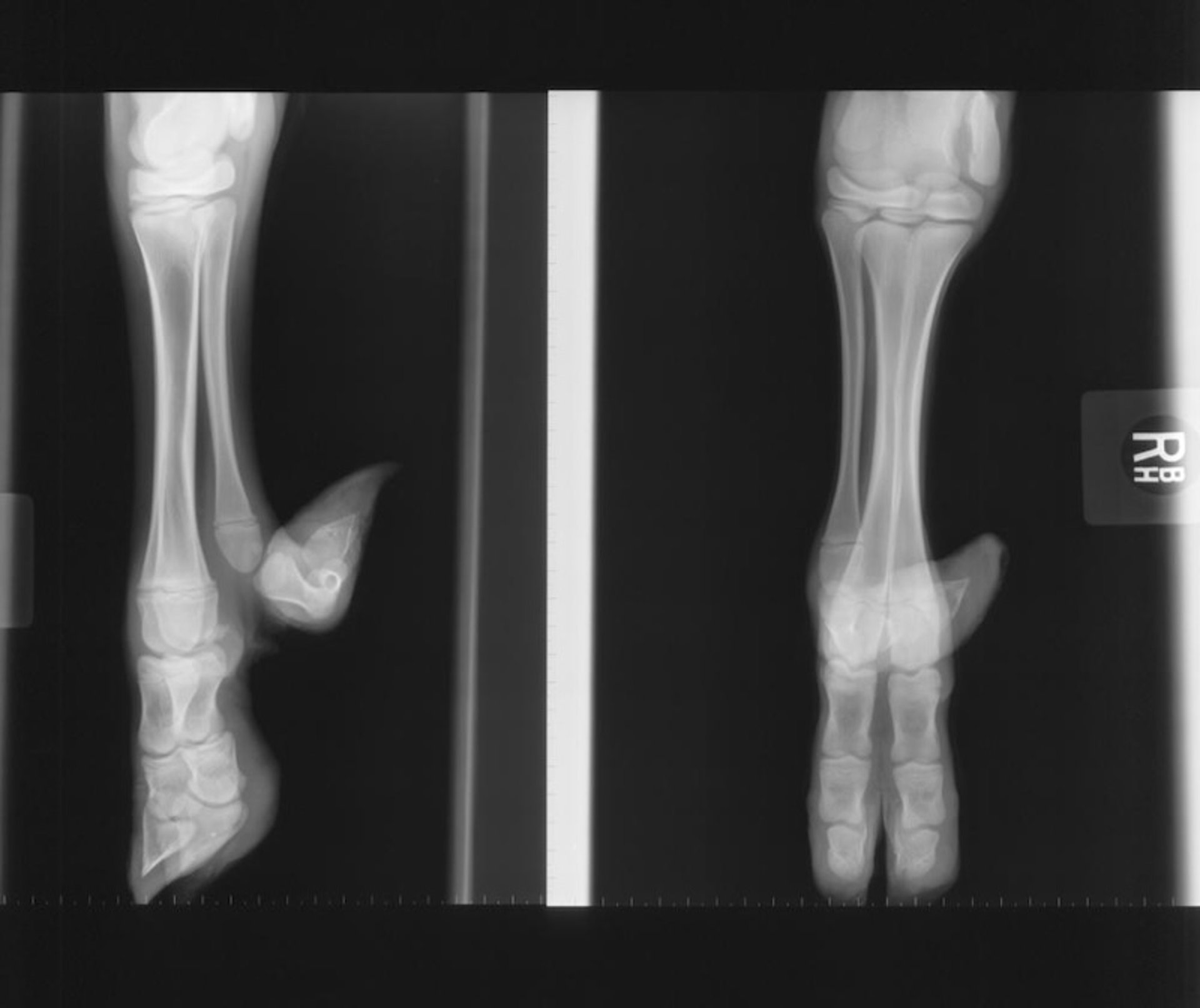 Polydactyly, radiograph, calf