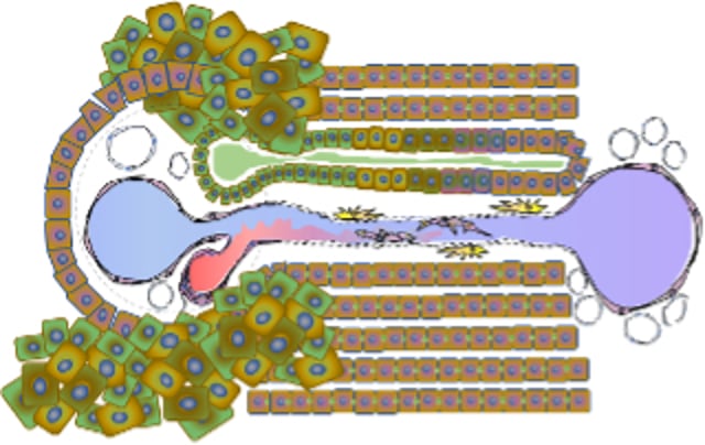 Portal tract, ductular reaction