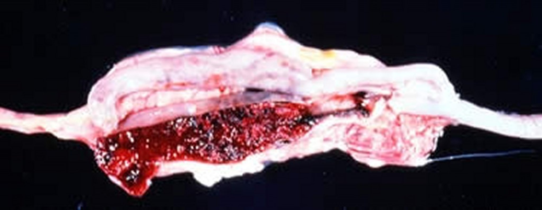 <i >Eimeria tenella</i>, lesiones macroscópicas, pollo de engorde