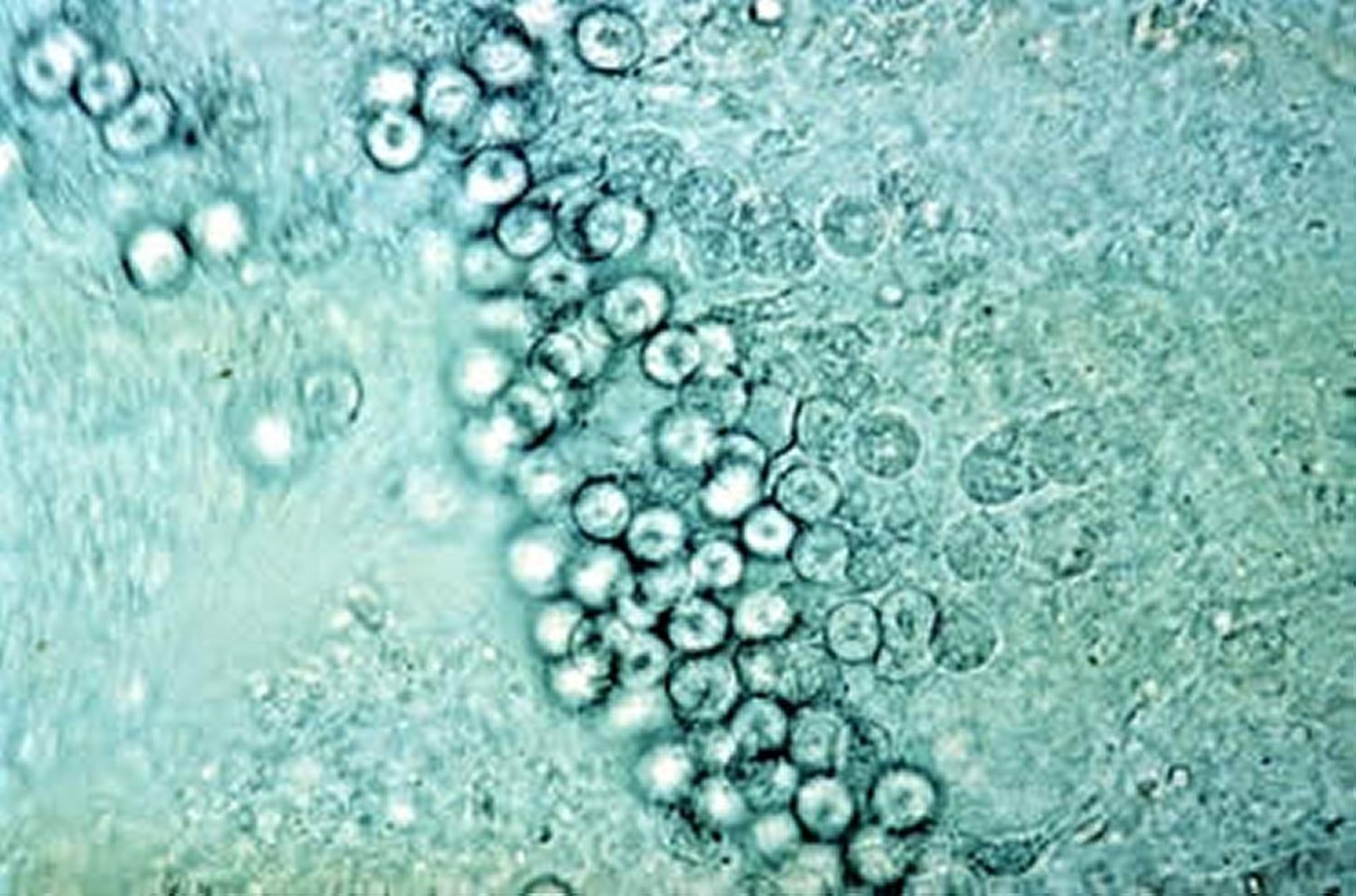 <i >Eimeria acervulina</i>, etapas de desarrollo, ave