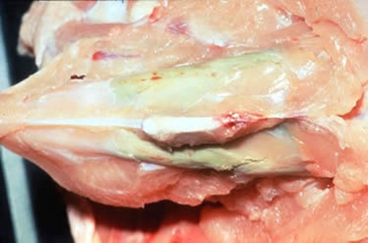 Miopatía del pectoral profundo y necrosis muscular, ave