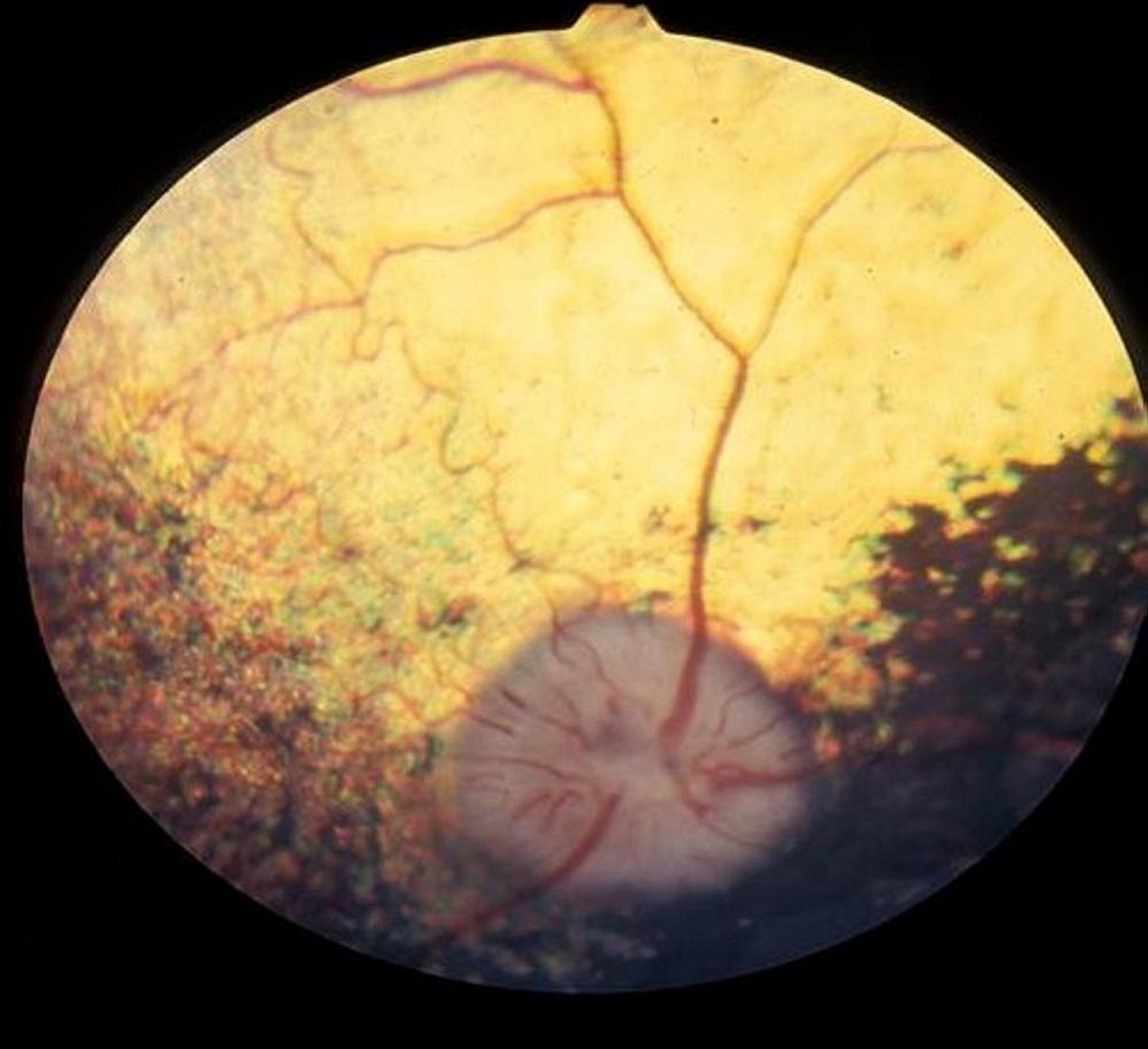 Atrofia progressiva da retina, collie