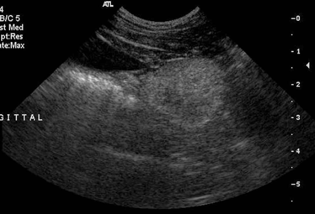 Prostate, sagittal ultrasonogram, dog