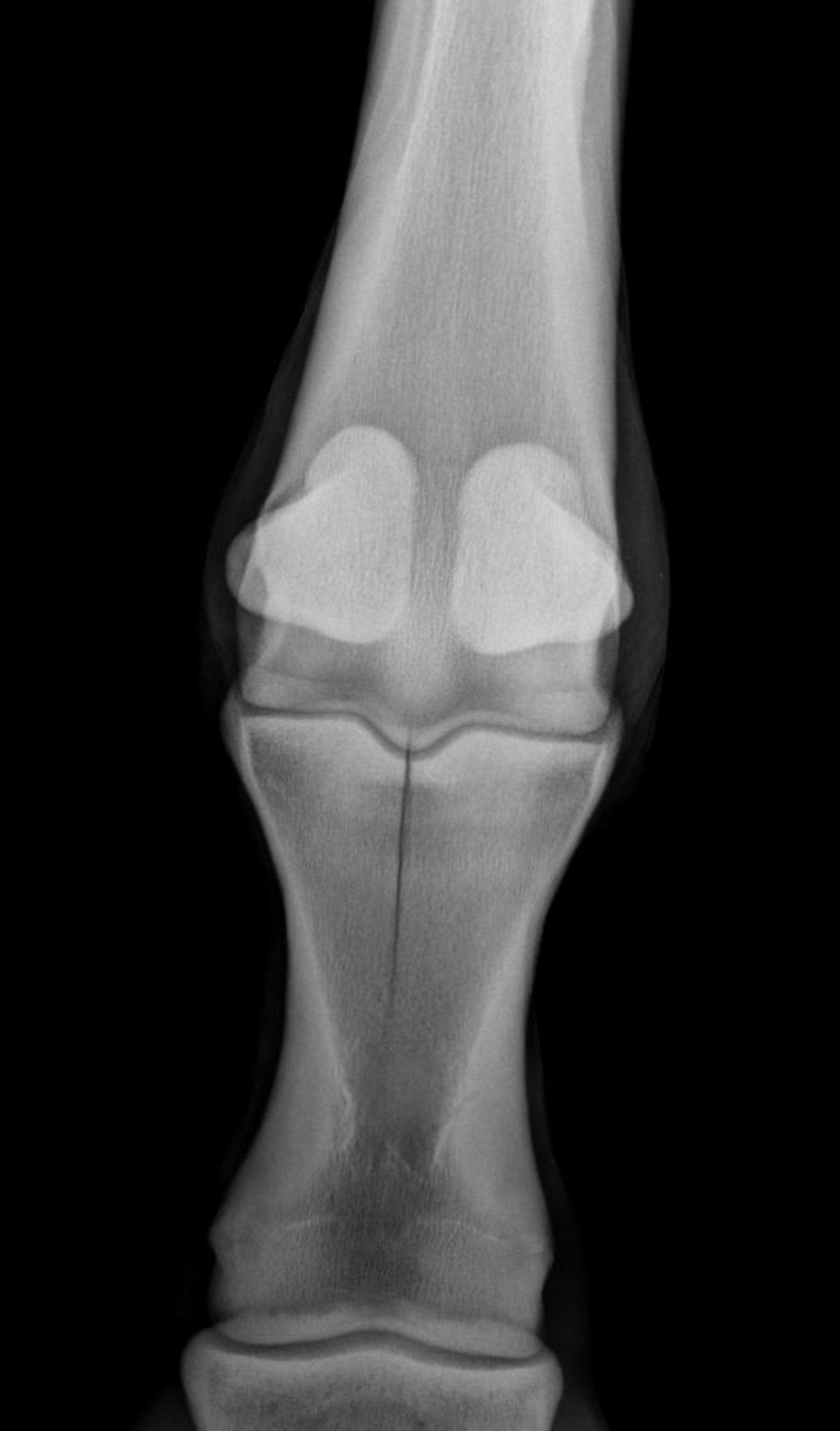 Fractura de la falange proximal, caballo