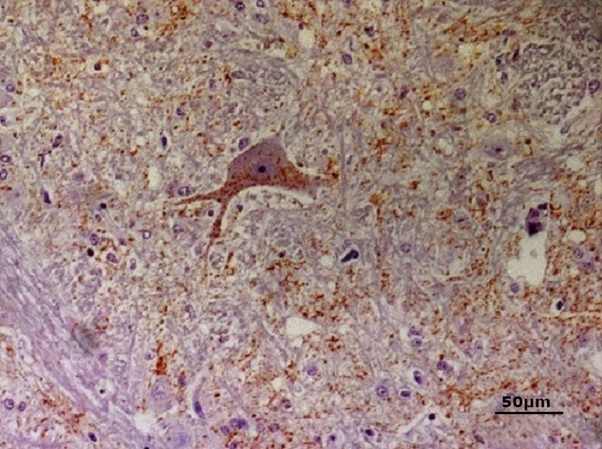 Depósito de príons PrP<sup >Sc</sup> na encefalopatia espongiforme bovina