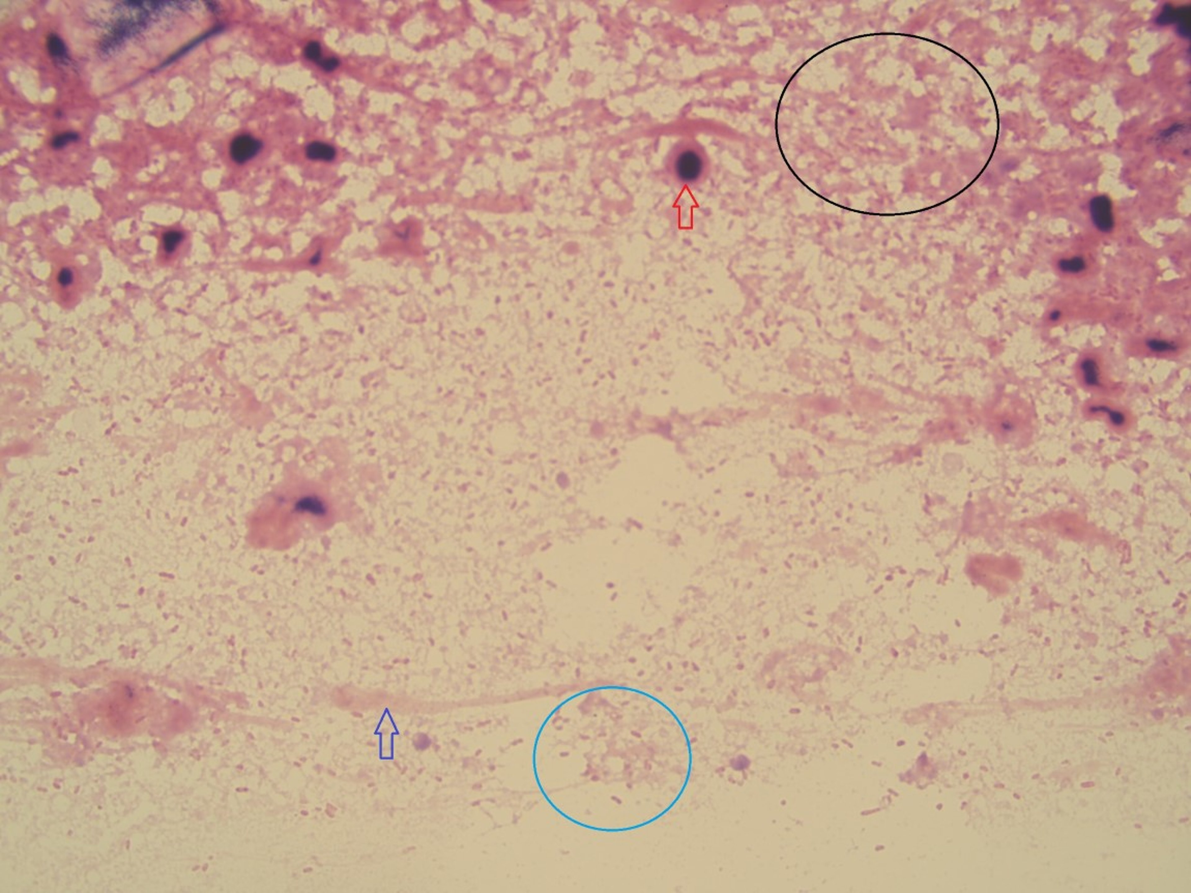 <i >Pseudomonas</i> infection, Gram stain, ear, dog