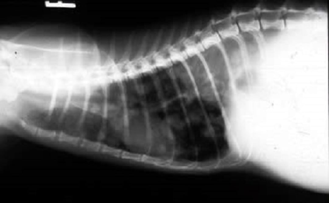 Metástasis pulmonar, radiografía