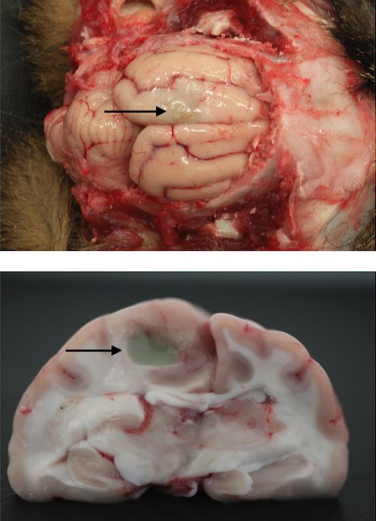 Puncture wound, cerebral hemisphere, cat