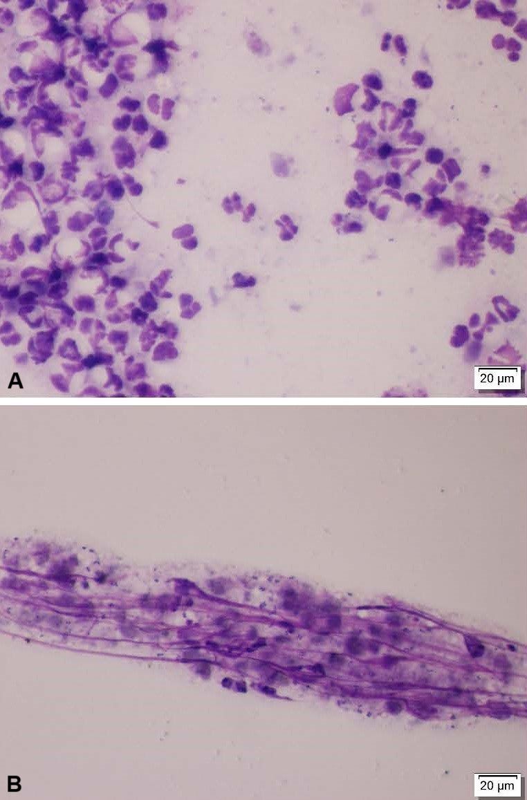 Image:Pyoderma, impression smear photomicrographs, dog-Merck Veterinary ...