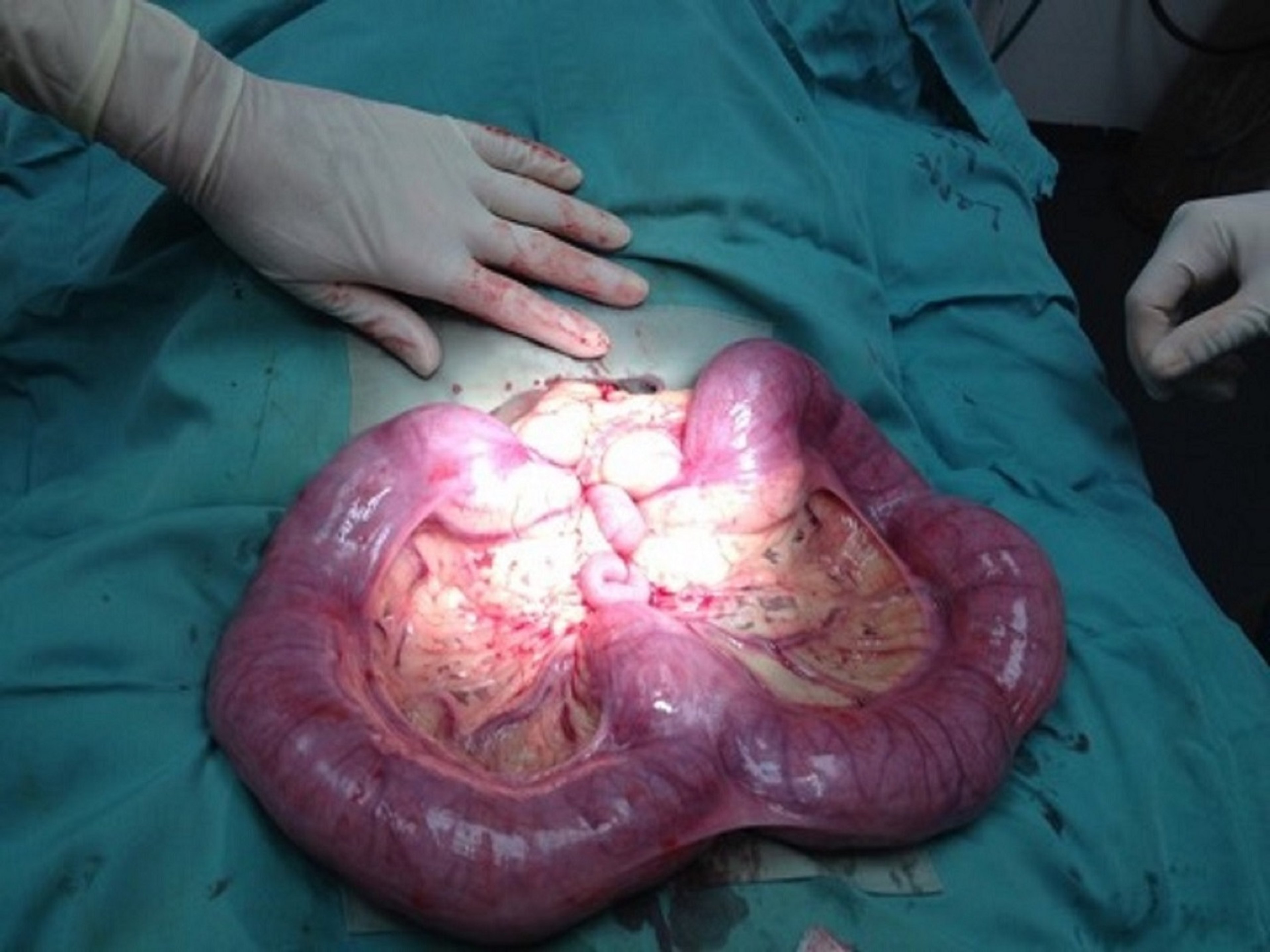 Pyometra, dog