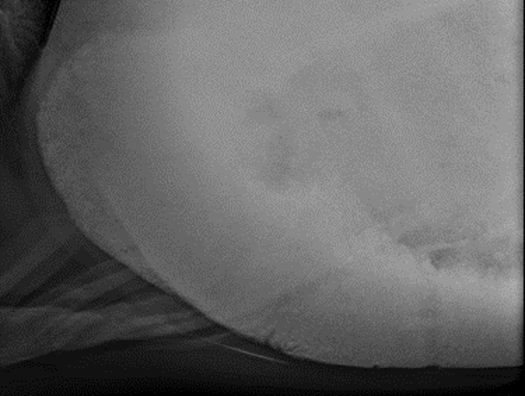 Sand in ventral colon, horse