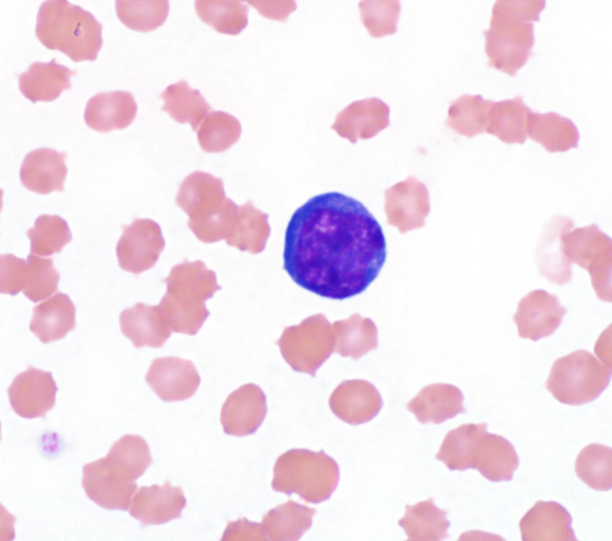 Reactive lymphocyte, blood smear, dog