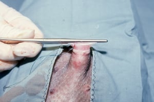 Removal of preputial diverticulum, miniature pig