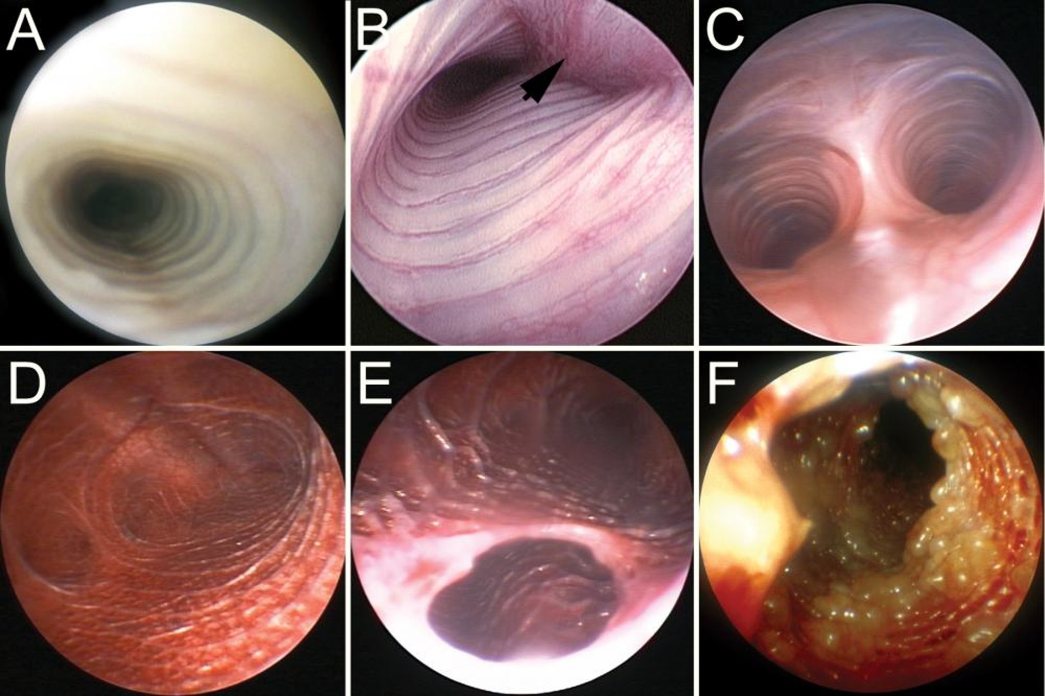 Tracheobronchoscopy, various reptiles