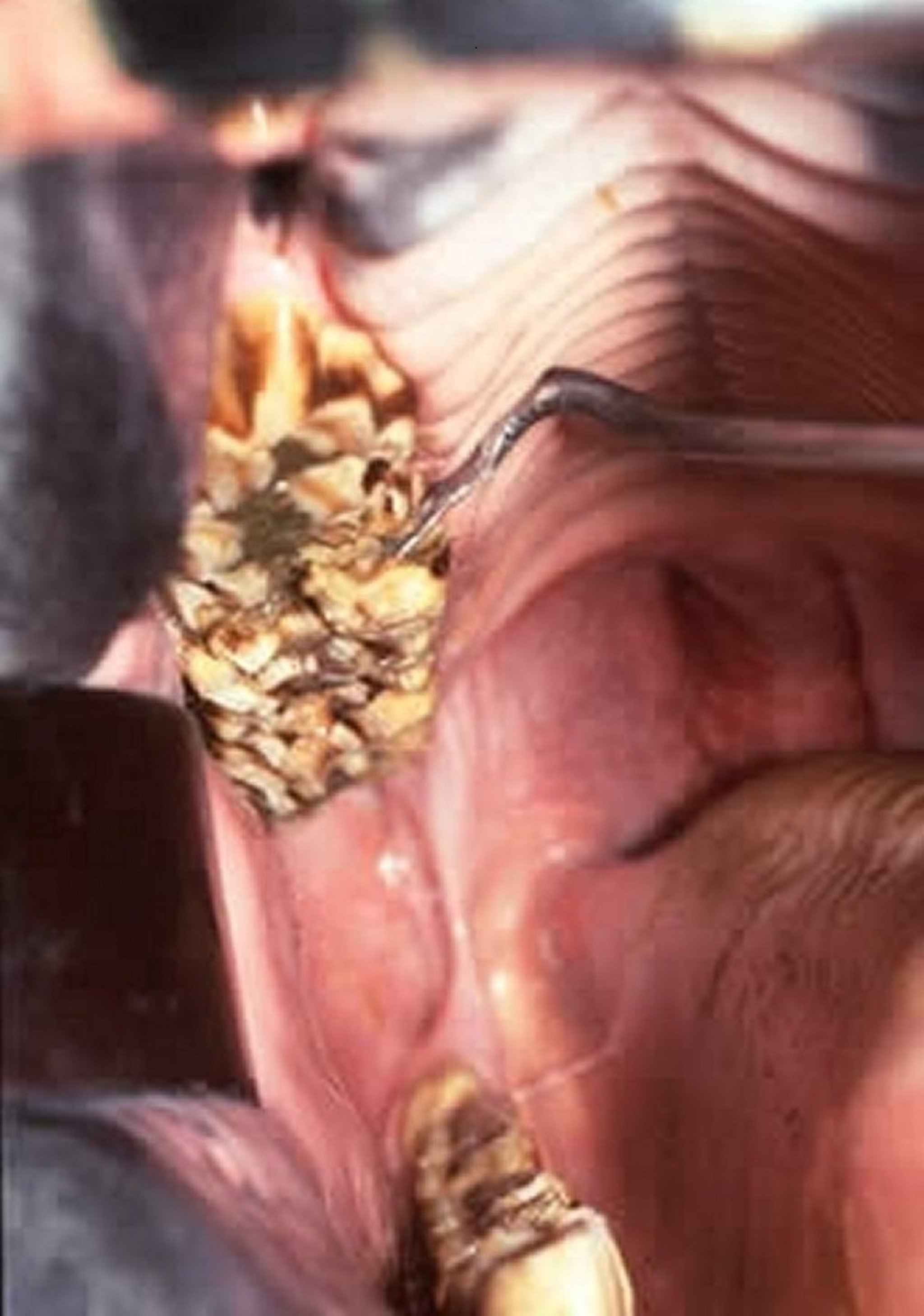 Retained deciduous premolars, horse