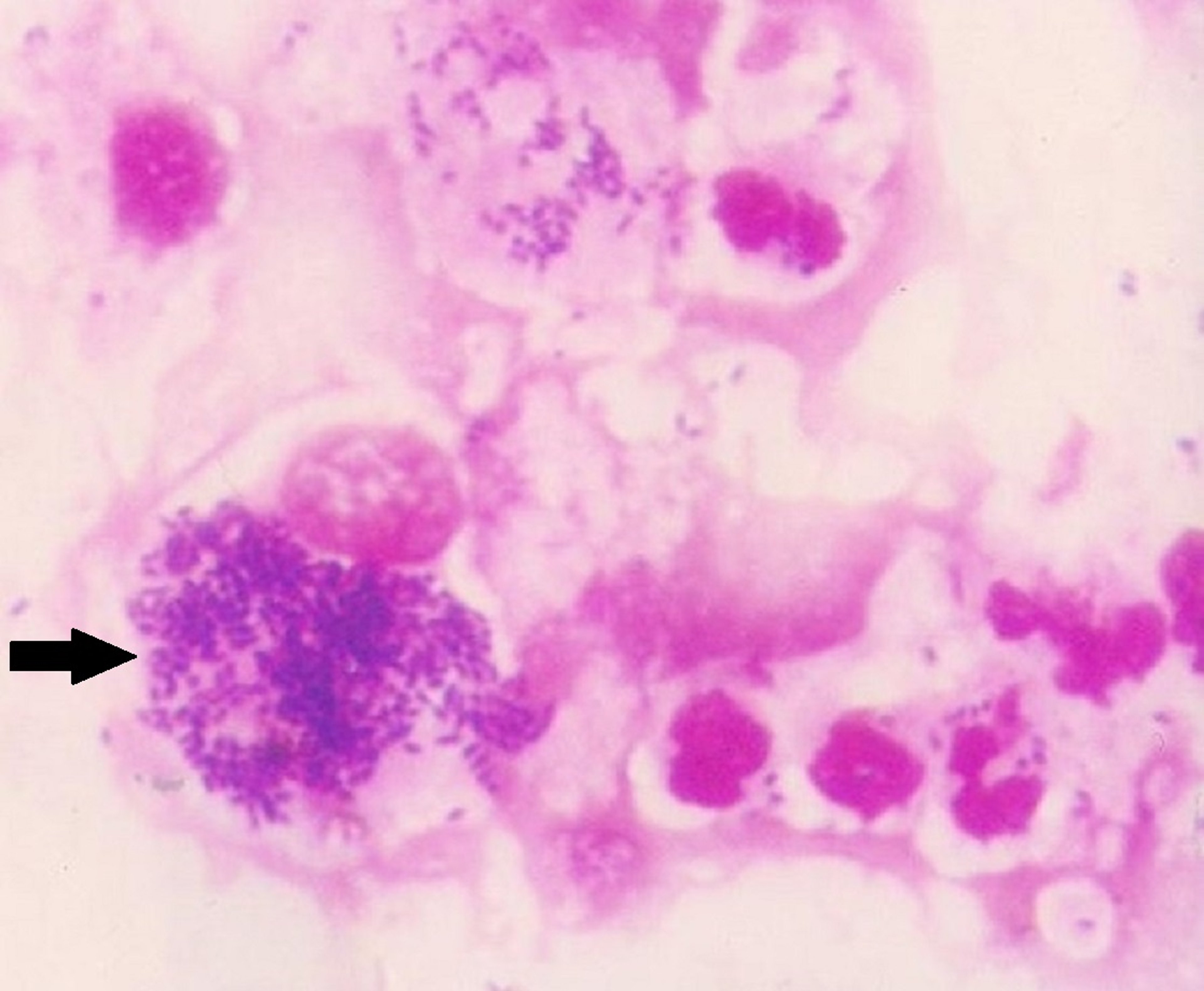 <i >Rhodococcus equi</i> pulmonary infection, foal